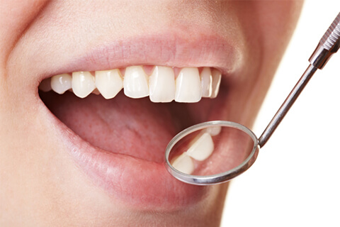 Rehabilitación Oral o Implantalogía